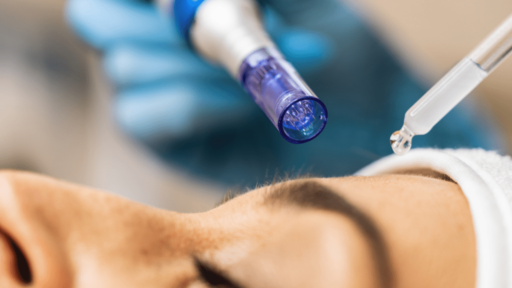 Microneedling à Rabat – Traitement de régénération de la peau pour un teint plus lisse et plus uniforme chez Cabinet BK