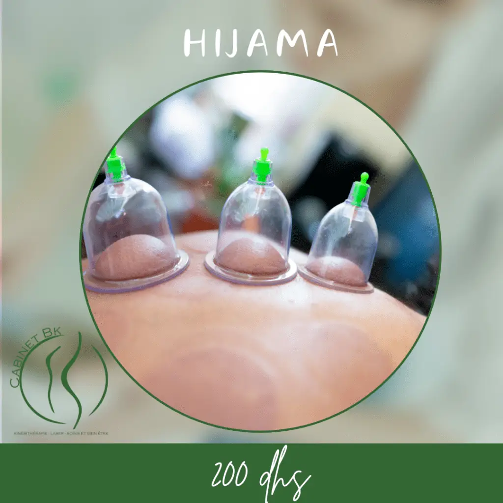 Hijama à Rabat pour détoxifier le corps, améliorer la circulation et soulager les douleurs – Cabinet BK