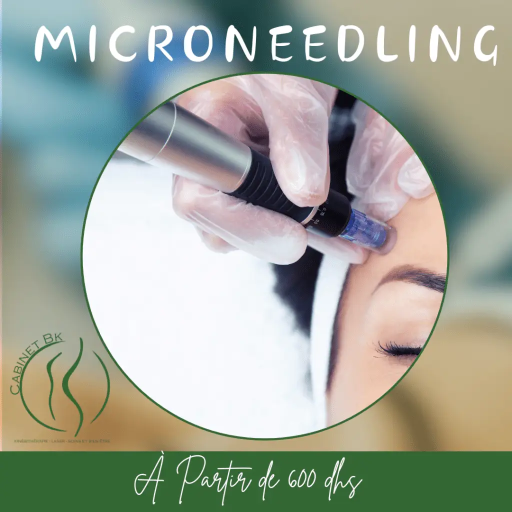 Microneedling à Rabat – Soin de régénération cellulaire et amélioration de la texture de la peau chez Cabinet BK